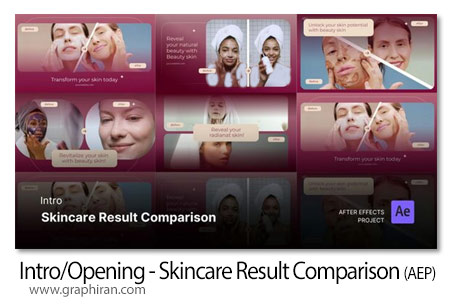 پروژه افترافکت مقایسه نتایج مراقبت پوست Intro/Opening - Skincare Result Comparison